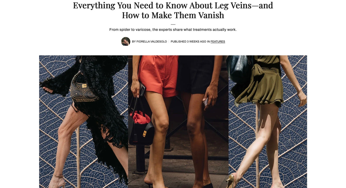 Marie Claire: Everything You Need to Know About Leg Veins—and How to Make Them Vanish